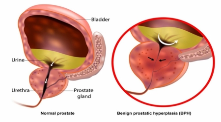 Best Kidney Hospital near me